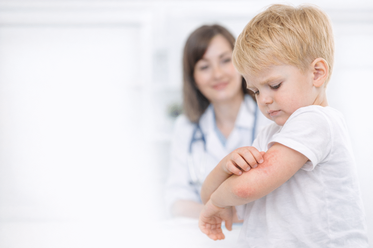 Алергія у дитини: 7 порад лікаря-алерголога
