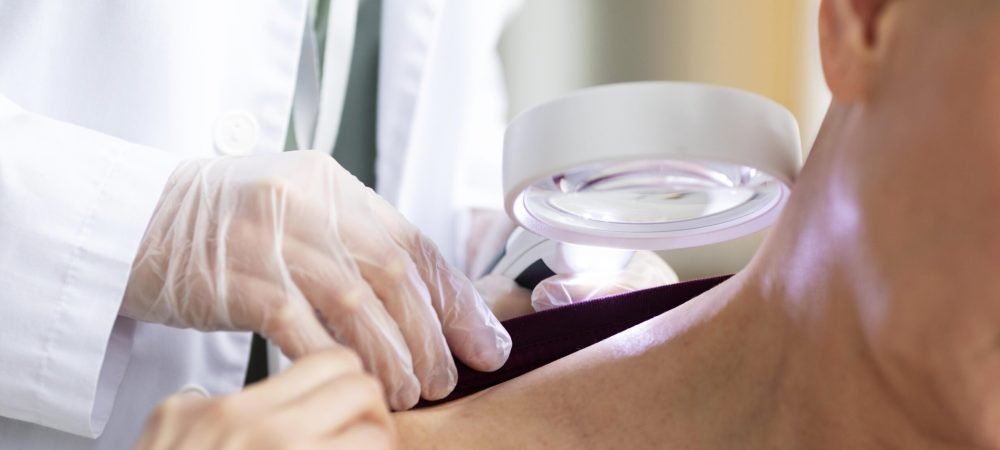 doctor-doing-check-patient-with-skin-cancer