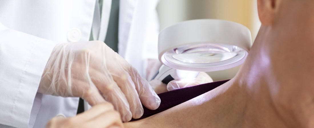 doctor-doing-check-patient-with-skin-cancer