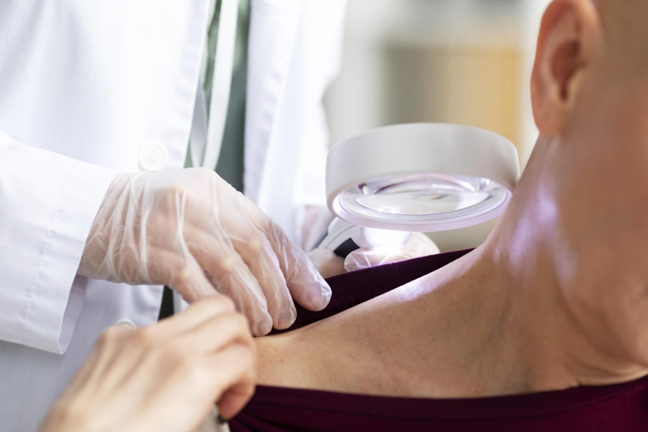 doctor-doing-check-patient-with-skin-cancer