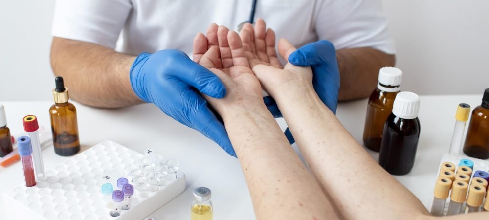 skin-allergy-person-s-arms